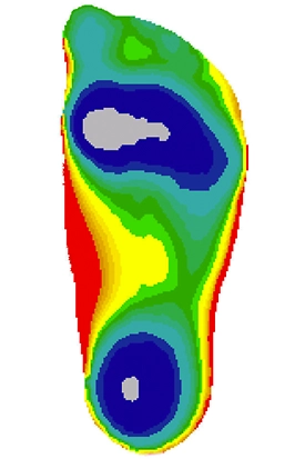 3D Fußsohle